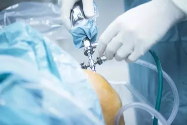 shoulder surgery for bankart repair in Purnia, Bihar